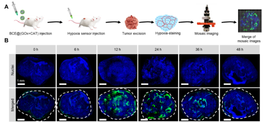 中國科學(xué)技術(shù)大學(xué)王育才教授:納米級(jí)聯(lián)簇化酶用于腫瘤葡萄糖耗竭治療